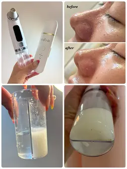 洗顔→毛穴洗浄→ウォーターピーリング→炭酸ガスパック美容液仕上げで今まで悩んでた毛穴汚れが取れ、引き締まった艶肌へ‼️