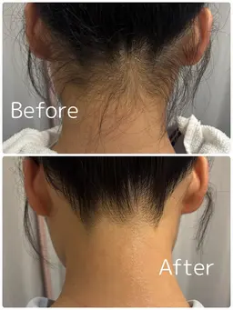 💗首元 美人💗 うなじシェービング