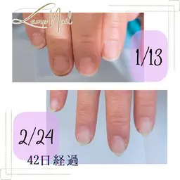 美爪育成💅深爪・むしり爪・噛み爪