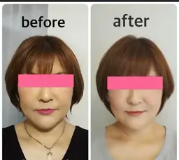 痛くない小顔矯正➕超脳クレンズ　ヘッドマッサージ