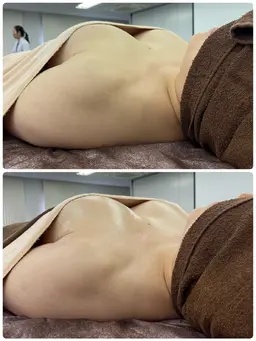 【ブライダル・プレ花嫁向け】ドレスの胸元をボリュームアップ！デコルテふっくらのバストアップエステ