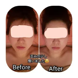 ミニモ限定【結婚式・成人式前など大切な日に向けて✨】セラピール3回＋骨気5回集中ケアコース