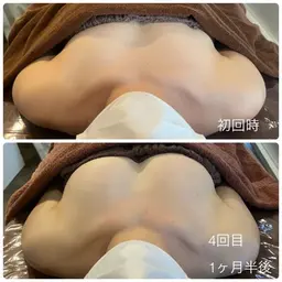 【お時間限定】プレミアム育乳コース☆本気でボリュームアップしたい方☆ハンドマッサージ×生体電流×光豊胸×美容液導入