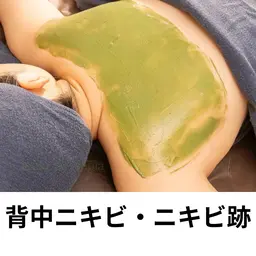 【ブライダル】＼ 背中ニキビ・ニキビ跡でお悩みの方へ ／自分ではケアしにくい背中の肌トラブルを、天然ハーブの力で徹底ケア