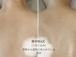 🩵minimoセール🩵【 背中全体ワックス脱毛(うなじ･背中･腰)🎀 】