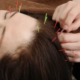 💤快眠💤頭皮鍼+パルス(電気鍼)ヘッドスパ、ヘッドマッサージ