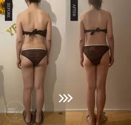 🉐【汗だくデトックス🔥ビフォーアフターで一目瞭然】よもぎ蒸し30分+脂肪温熱痩身マシンセルゼロ90分<120分>