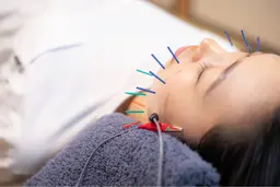 🥇人気No.1🥇気になる毛穴の開きにも⚡️最先端電気美容鍼⚡️㊙️ミニモ限定価格㊙️