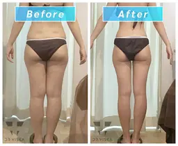 ⭐️痩身エステ⭐️お試し40分コース‼️(両足、お腹、背中二の腕)の中から1部位🍃