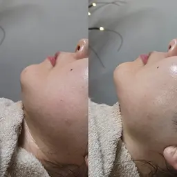 "艶"爆誕ガラス肌コース