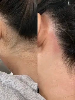 パーツwax🪄『うなじ』•『おでこ』•『もみあげ』いずれか1箇所wax🍯🪄