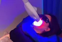 初めてのホワイトニング応援✨セルフホワイトニング2照射30分🦷