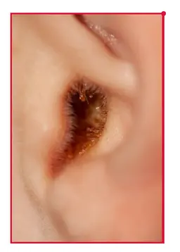 4月末までキャンペーン‼️あと3名限定❣️耳そうじ👂　イヤースコープ付き耳かき✨