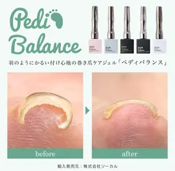 巻き爪ケア含めた1カラー👣【PediBalance】