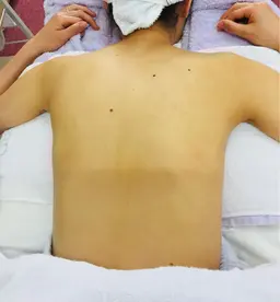 1日ブライダルコース💒一度でこんなに白く😍お顔つやつや✨＆背中美人に！背中の開いたドレスも👗堂々と着られます❣️