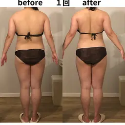 全身燃焼デトックス痩身120分🔥ラジオ波×痩身ハンドで全身むくみ・セルライト徹底ケア