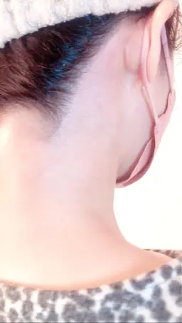 頭髪部(太い毛)含む【うなじワックス脱毛】うなじ​〜​首後ろ​〜​首下をWax脱毛✨どんなに毛が多くてもその場でキレイに👍✨