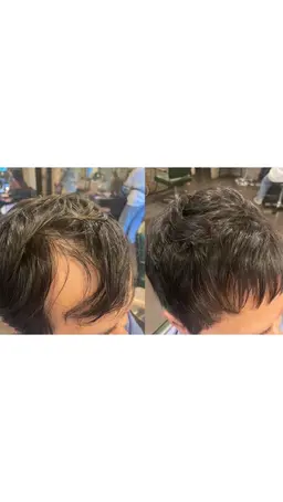 薄毛専用カット＋薄毛無料カウンセリング