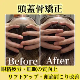 ❤️‍🔥肩こり&頭痛の悩みにオススメ❤️‍🔥上半身筋膜リリース+頭蓋骨矯正+小顔 90分¥33,000→¥3,300