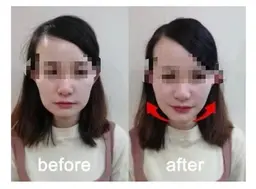 人気NO1【3D最強小顔コルギ+ハイパー】60