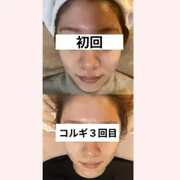 たるみスッキリ✨小顔コルギ×極楽ヘッドスパ付き