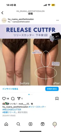 【筋膜リリース】下半身脚引き締め・ヒップup・むくみ30分¥11,000→¥9,000