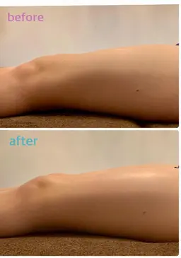 膝上お肉撃退!! 全身リンパマッサージ+膝上スッキリコース