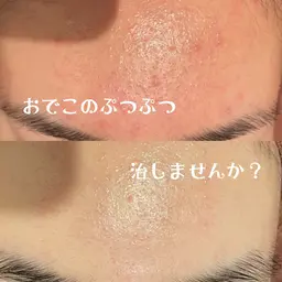 【ブライダルメニュー💍🤍】前撮りや結婚式に向けてイオンパックでのケアお任せください✨