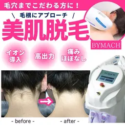 【過去最安値🉐】顔脱毛 ¥6,980 → ¥1,500