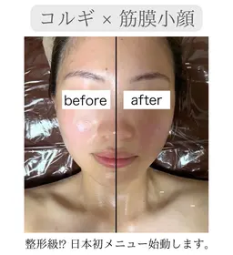 【日本初導入❤️‍🔥】コルギ×パワーレメディで3D小顔矯正💆🏻‍♀️✨速攻で整形級の変化に🥹