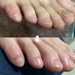 (フット)お爪整え+甘皮処理/みちがえる足爪コース