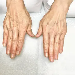 スタンダードコース（トリートメントのみ）