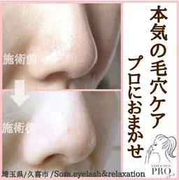 毛穴洗浄&リフトUPエステ ¥6480⇒¥4980