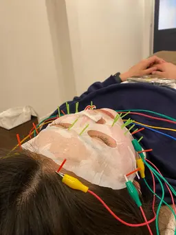 パック＋美容鍼（電気鍼）＋小顔矯正（乾燥肌　保湿ケア　美白ケア）