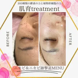 陶肌トリートメント小顔 美白コース💎