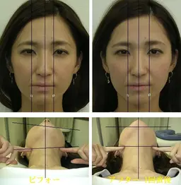 【新規】顎関節矯正・アゴの不調・開口辛さ・ガクガク感◆¥9,400 → ¥4,980現金限定