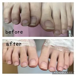 【足爪お手入れ+足裏角質除去】オフ無料/爪のお手入れ/足裏角質除去/フットバス/保湿パック/ふわつやの素肌へ