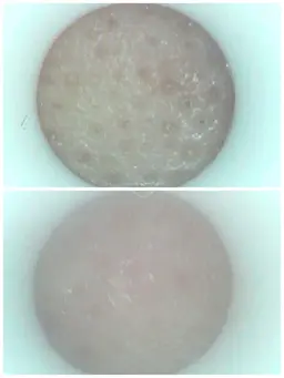 【黒ずみ悩みの方必見】毛穴吸引~デコルテ・首・ヘッドのほぐし付き60分+カウンセリング10分