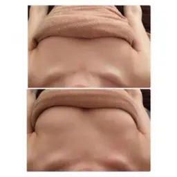 ミラクルウェーブ(バストアップ)+コラーゲンマシン40分