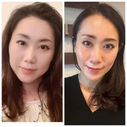 ダイヤモンド💎ピールプログラム