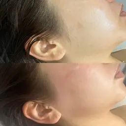 😶Face wax 2箇所✨