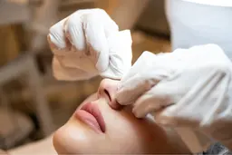 エクストラクションで角栓、黒ずみゴッソリ取り除く‼️毛穴エクストラクションコース