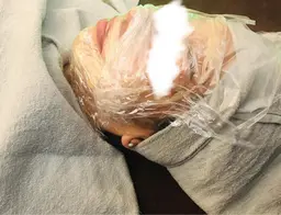 🔴ミニモ限定メニュー マツヤニWAX&フェイシャルマッサージ&腸もみ&肩揉み