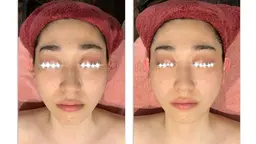 ぷるぷる極上美肌コース