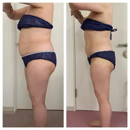 超音波、キャビテーション、EMSを使って美ボディに＊痩身エステモデル＊下半身スッキリコース