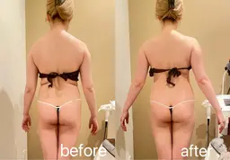 【ミニモ限定】即効✨二の腕、肩甲骨出すケア✨ハイパーナイフEX ➕リンパマッサージ　60分