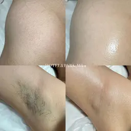 4/12限定🫧【VIO＋(両脇orヒップ)ワックス脱毛】