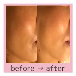 何度でも利用可🧸お顔集中🩷クイックエステ💆‍♀️