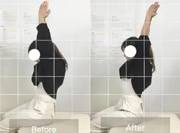 【肩スッキリ!!NAORU式肩甲骨剥がし×姿勢 整体】AI検査付き¥7,700→¥4,500