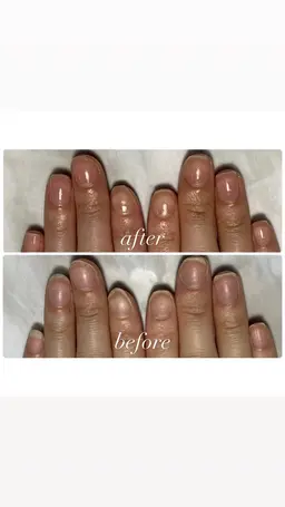 自爪育成(ジェルあり)単品